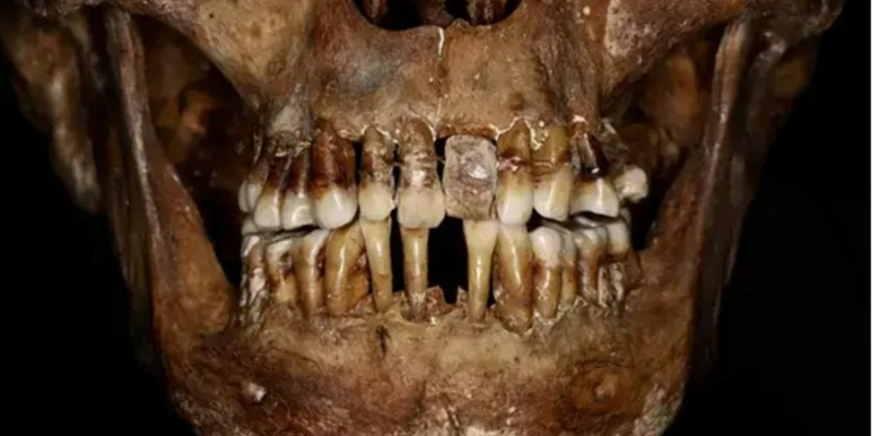 Довелося йти на жертви. Учені дізналися секрет догляду за зубами аристократки з XVII століття